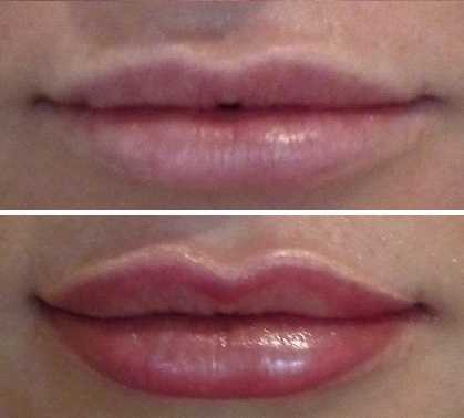 Before & After Lip Volumising Tattooing
