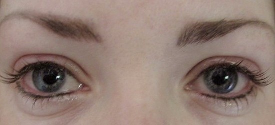 Eyeliner tattooing - Positive Outcomes
